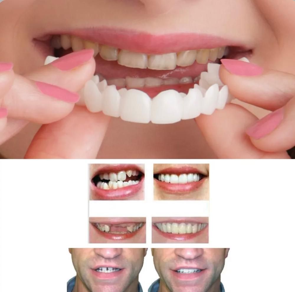 لمینت متحرک دندان|آرایشی، بهداشتی، درمانی|سنندج, |دیوار