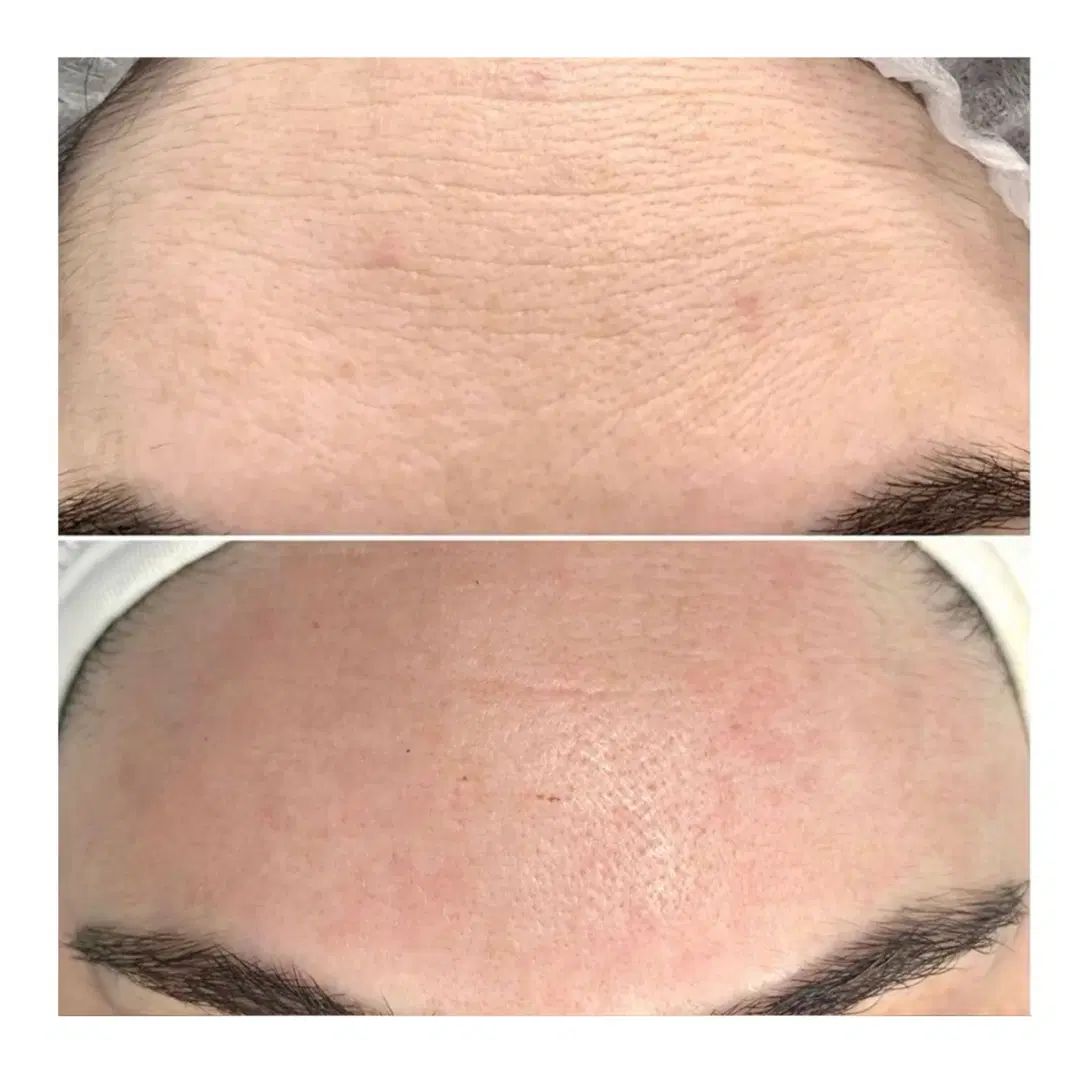 جوانسازی فوری/در یک جلسه/در یک ساعت|خدمات آرایشگری و زیبایی|رشت, کوی حسینی|دیوار