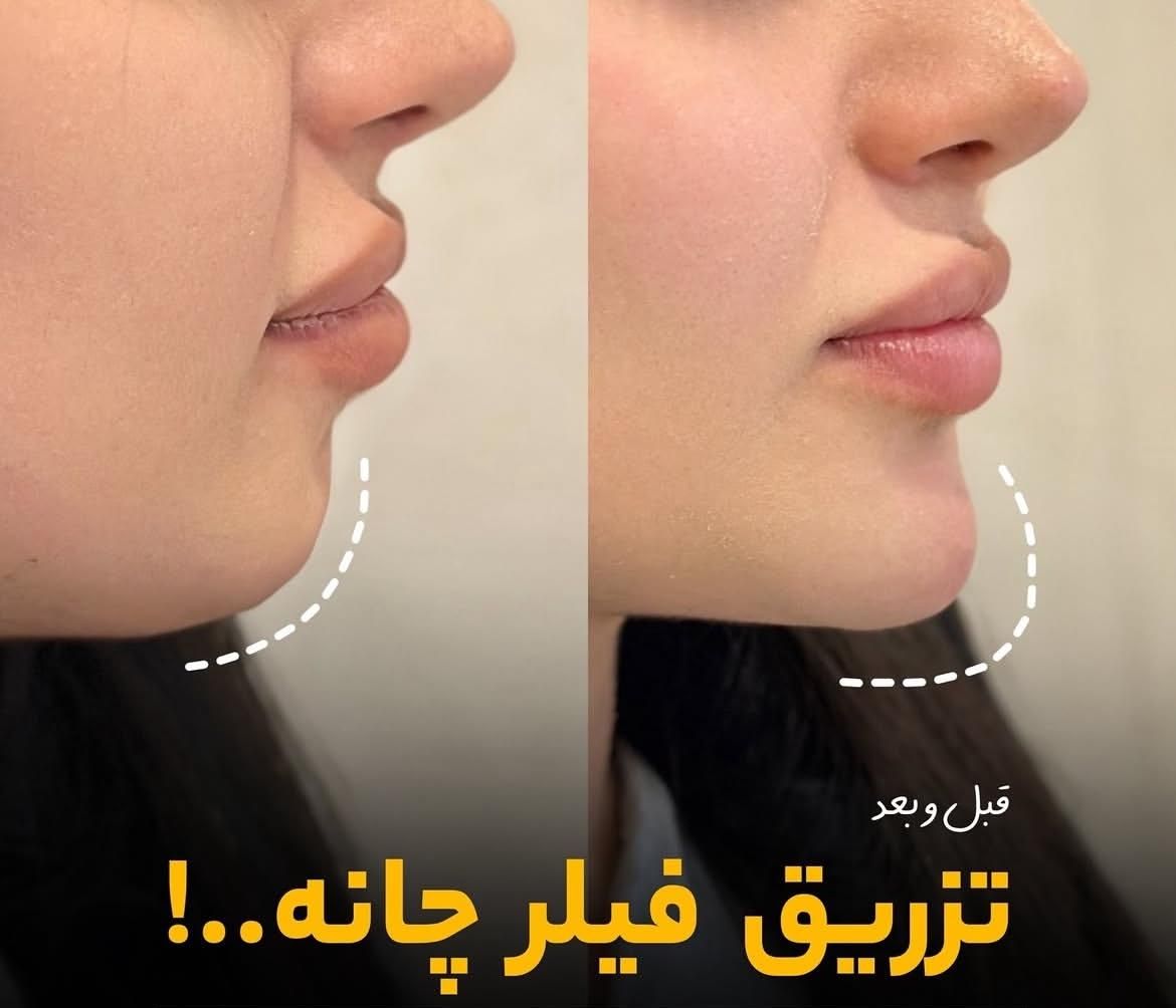 کلینیک زیبایی سلین|خدمات آرایشگری و زیبایی|تهران, خواجه نصیر طوسی|دیوار