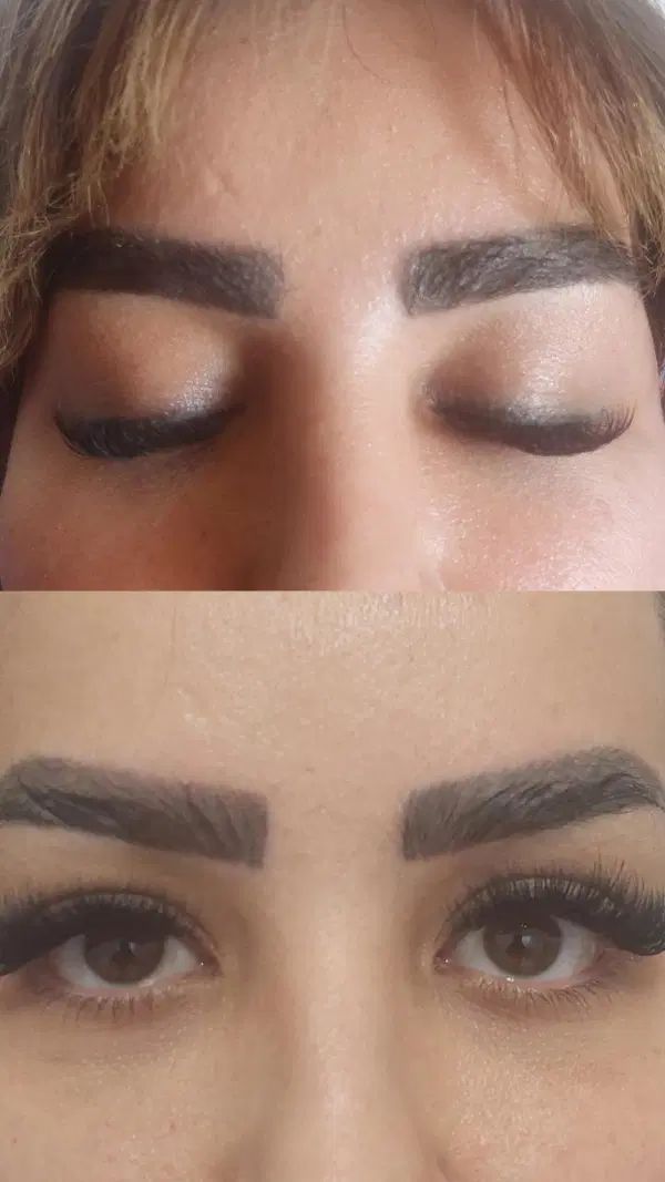 جشنواره کاشت مو ابرو ریش،خدمات زیبای تزریق و تخلیه|خدمات آرایشگری و زیبایی|تبریز, |دیوار