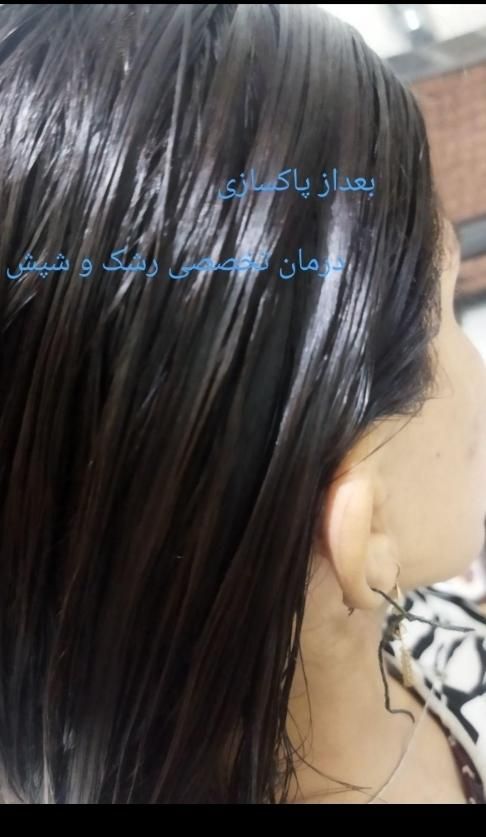 محلول تضمینی نابود کننده شپش و رشک|آرایشی، بهداشتی، درمانی|کرمان, |دیوار