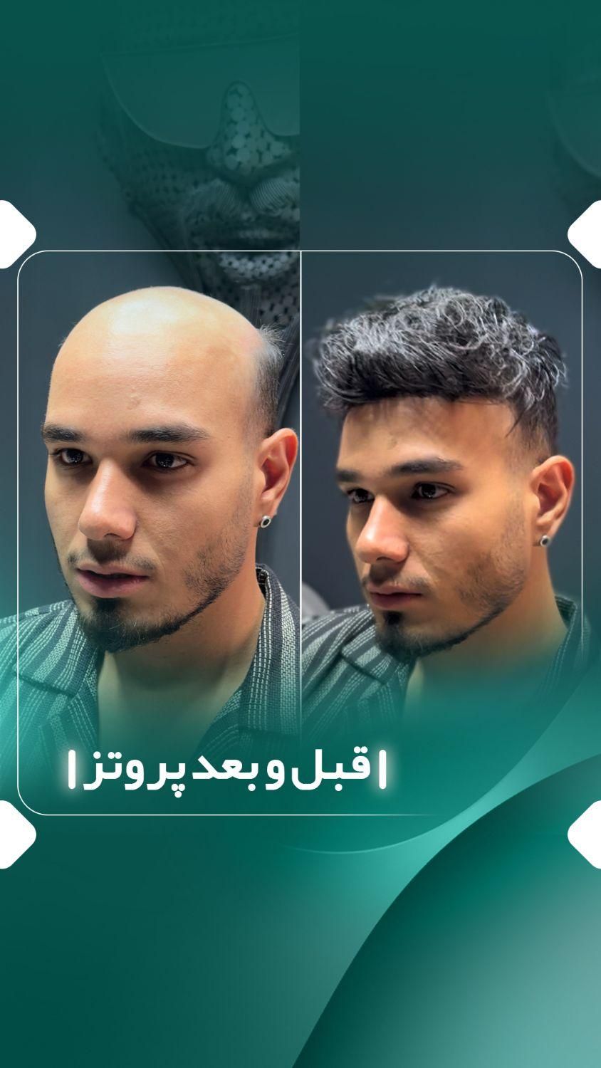 پروتزمو و ترمیم مو و تعمیرات و فروش|آرایشی، بهداشتی، درمانی|تهران, تهرانپارس غربی|دیوار