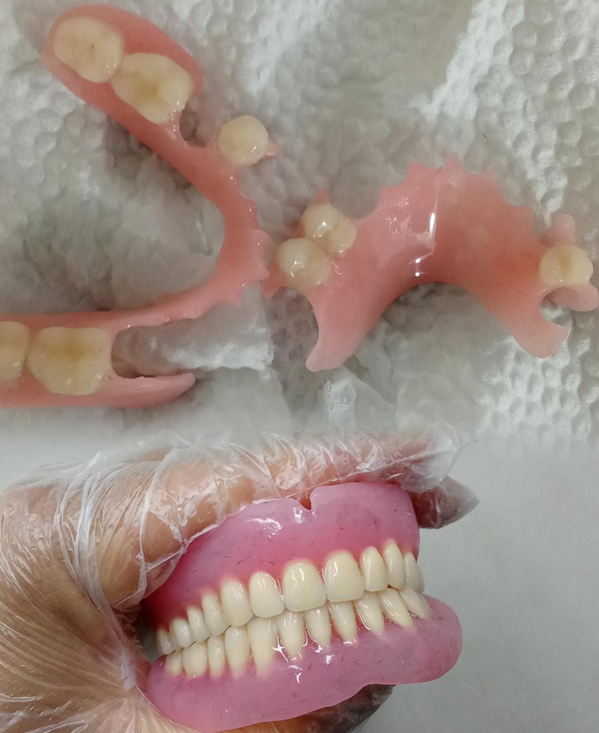 ساخت انواع دندان مصنوعی در سنندج|خدمات آرایشگری و زیبایی|کرمانشاه, |دیوار