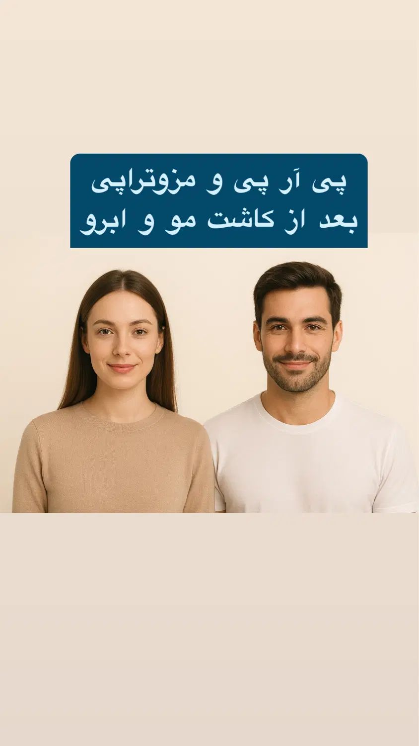 پی آر پی مو و صورت تخفیف ویژه پی ارپی بعدازکاشت مو|خدمات آرایشگری و زیبایی|قزوین, |دیوار
