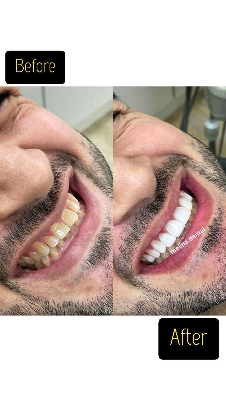 کلیه خدمات دندانپزشکی با بیمه های تکمیلی|خدمات آرایشگری و زیبایی|تهران, جهاد|دیوار