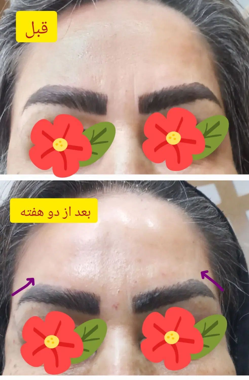 تخفیف بوتاکس، ژل، مزوژل، پی آر پی توسط پزشک|خدمات آرایشگری و زیبایی|مشهد, گوهرشاد|دیوار