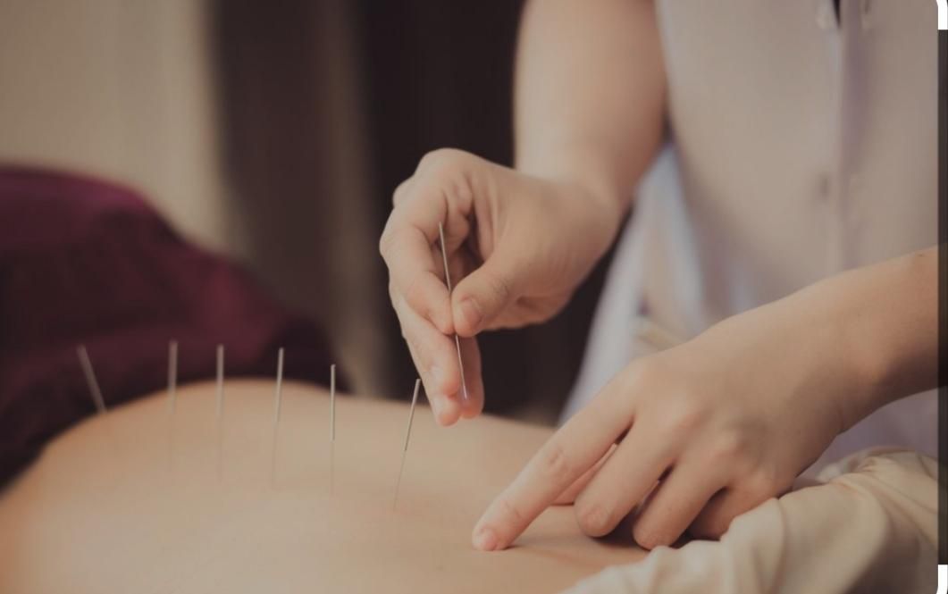 حجامت و زالوتراپی و طب سوزنی‌و پاکسازی بدن از سمو|خدمات آرایشگری و زیبایی|ارومیه, |دیوار