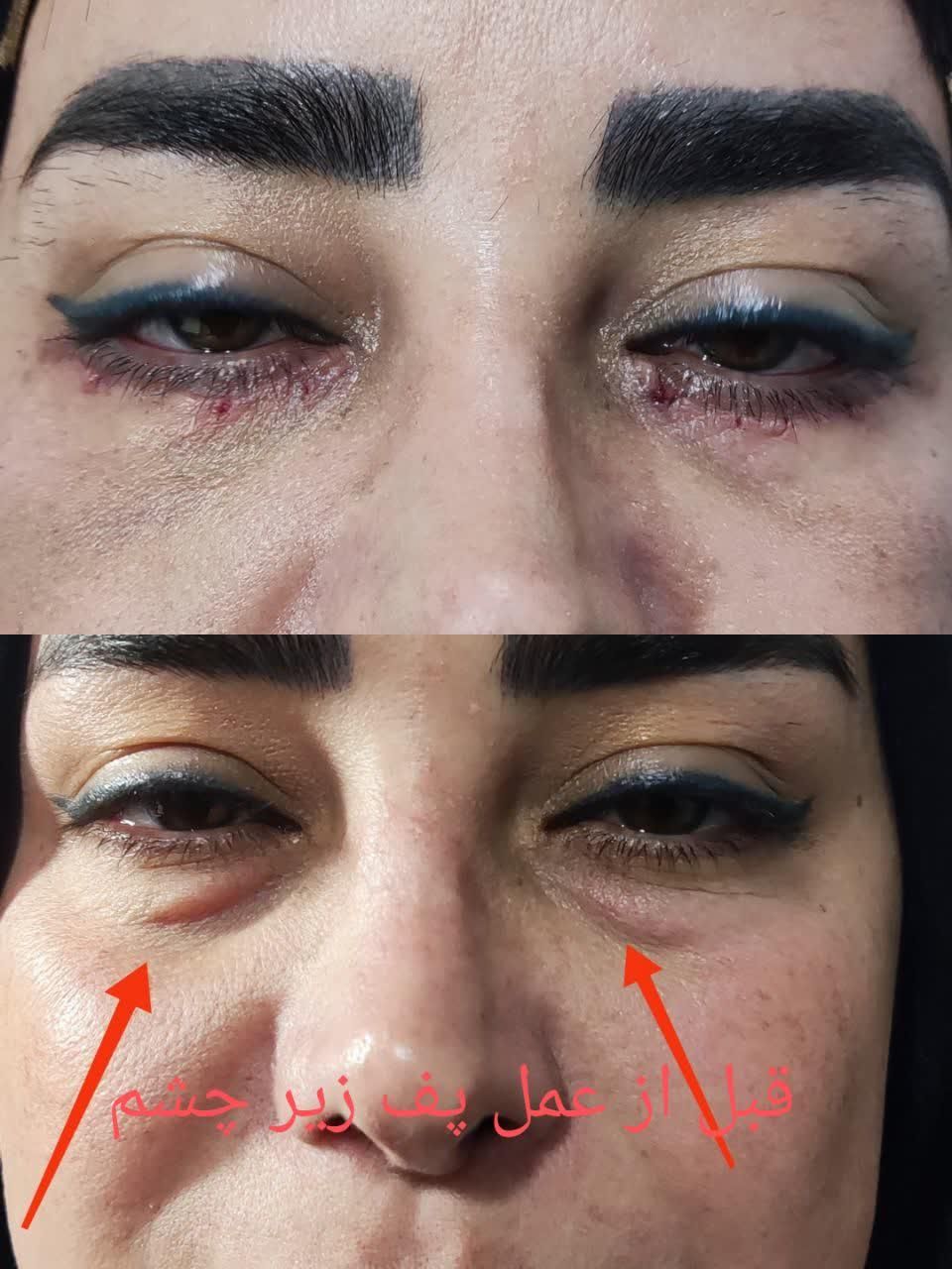 مرکز تخصصی جراحی بلفارو پلاستی دکتر الماس اسدی|خدمات آرایشگری و زیبایی|کرمانشاه, |دیوار