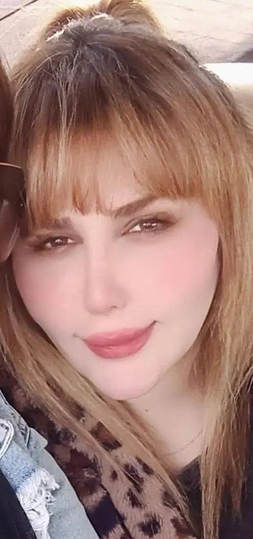 عمل رینوپلاستی و جراحی بینی عمل انحراف بینی|خدمات آرایشگری و زیبایی|اهواز, گلستان|دیوار