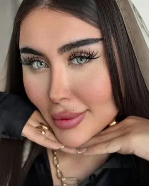 تزریق بوتاکس و لیفت چشم گربه ای  جدیدترین متد|خدمات آرایشگری و زیبایی|ری, دیلمان|دیوار