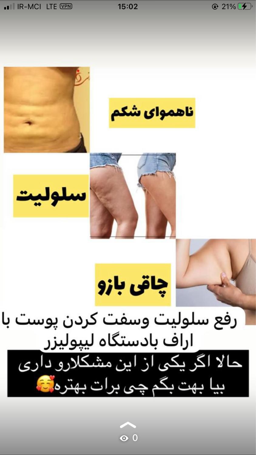 پاک کردن انواع تتو لاغری موضعی لیزر موهای زاید|خدمات آرایشگری و زیبایی|شیراز, حافظیه|دیوار