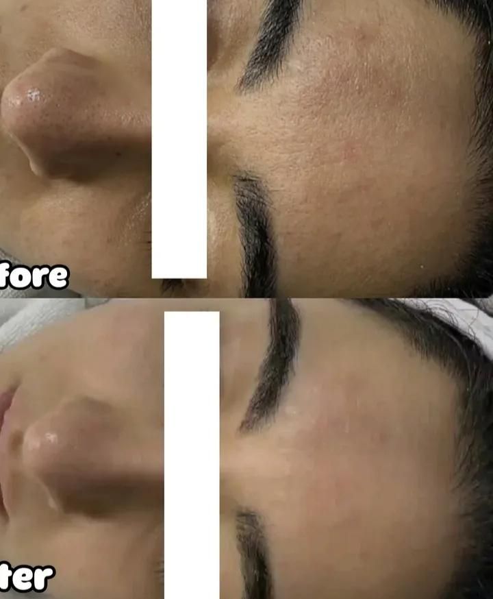 پاکسازی تخصصی پوست صورت|خدمات آرایشگری و زیبایی|اصفهان, فرح آباد|دیوار
