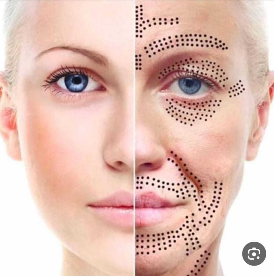 کوچک کردن بینی وجوان سازی پوست|خدمات آرایشگری و زیبایی|کوهدشت, |دیوار