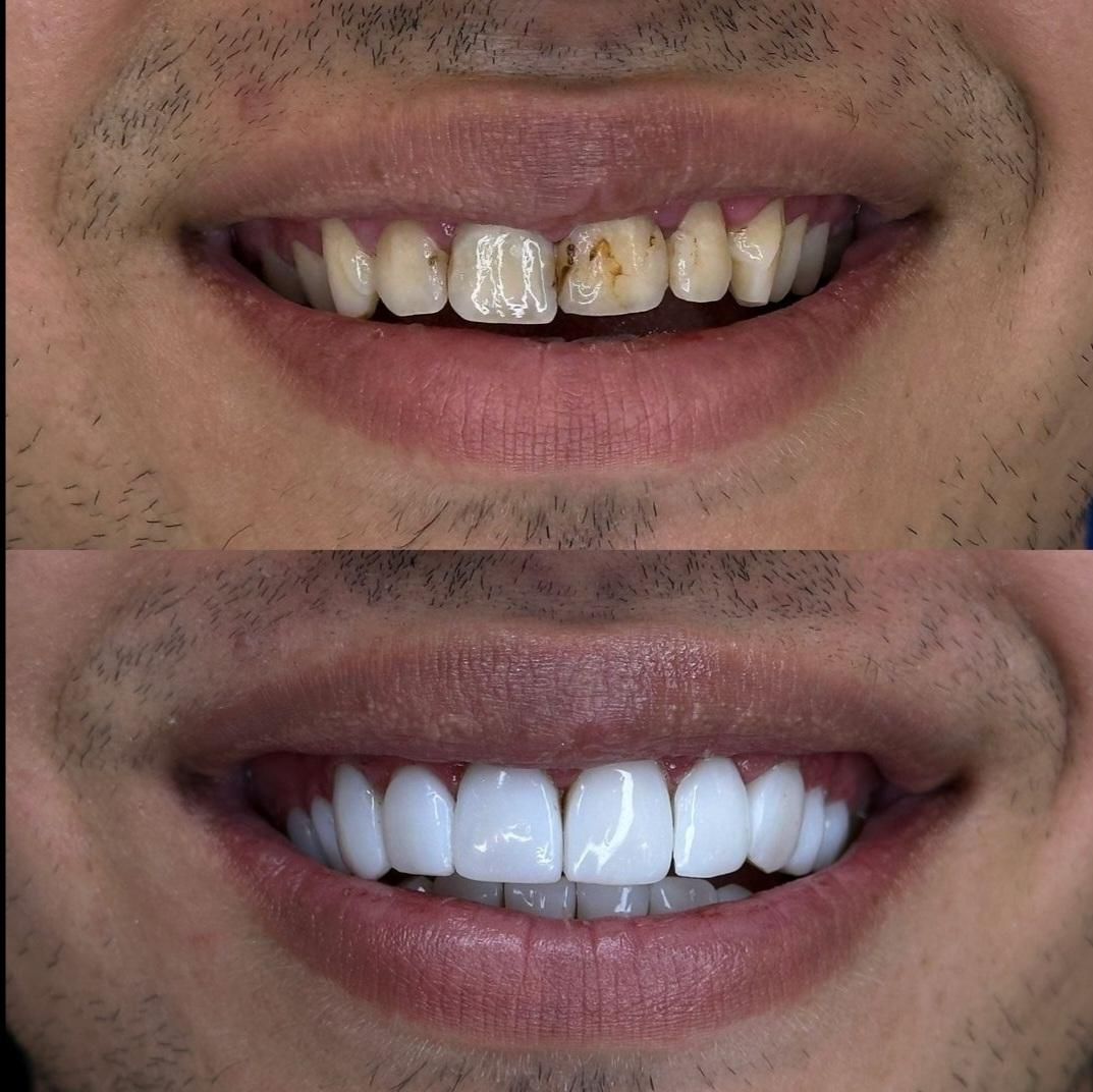 آموزش حرفه ای کار درمانی و زیبایی دندانپزشکی|خدمات آموزشی|تهران, مهرآباد جنوبی|دیوار