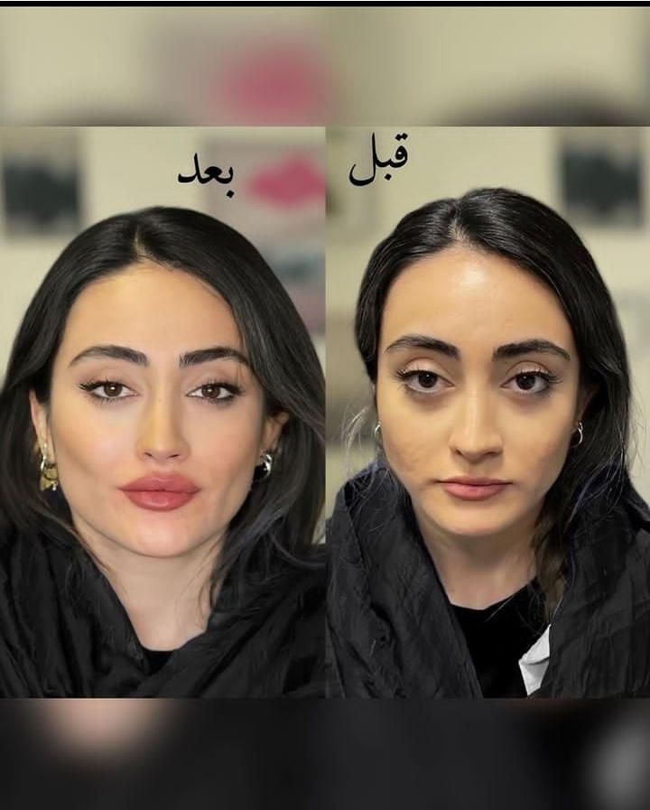 مطب پوست و مو و زیبایی|خدمات آرایشگری و زیبایی|تهران, سعادت‌آباد|دیوار