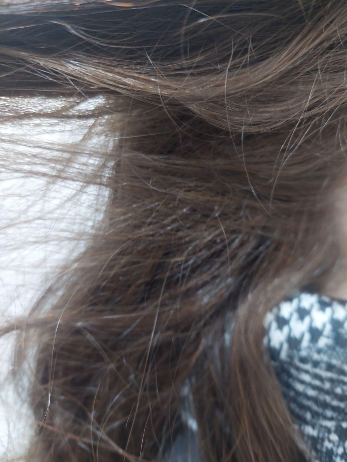 پاکسازی رشک و شپش موی سر در شهرک شهید رجایی|خدمات آرایشگری و زیبایی|مشهد, انصار|دیوار