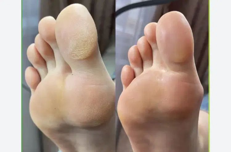 پدیکور و کفسابی-کاشت و ترمیم و ژلیش-لمینت|خدمات آرایشگری و زیبایی|کرج, اتحاد|دیوار