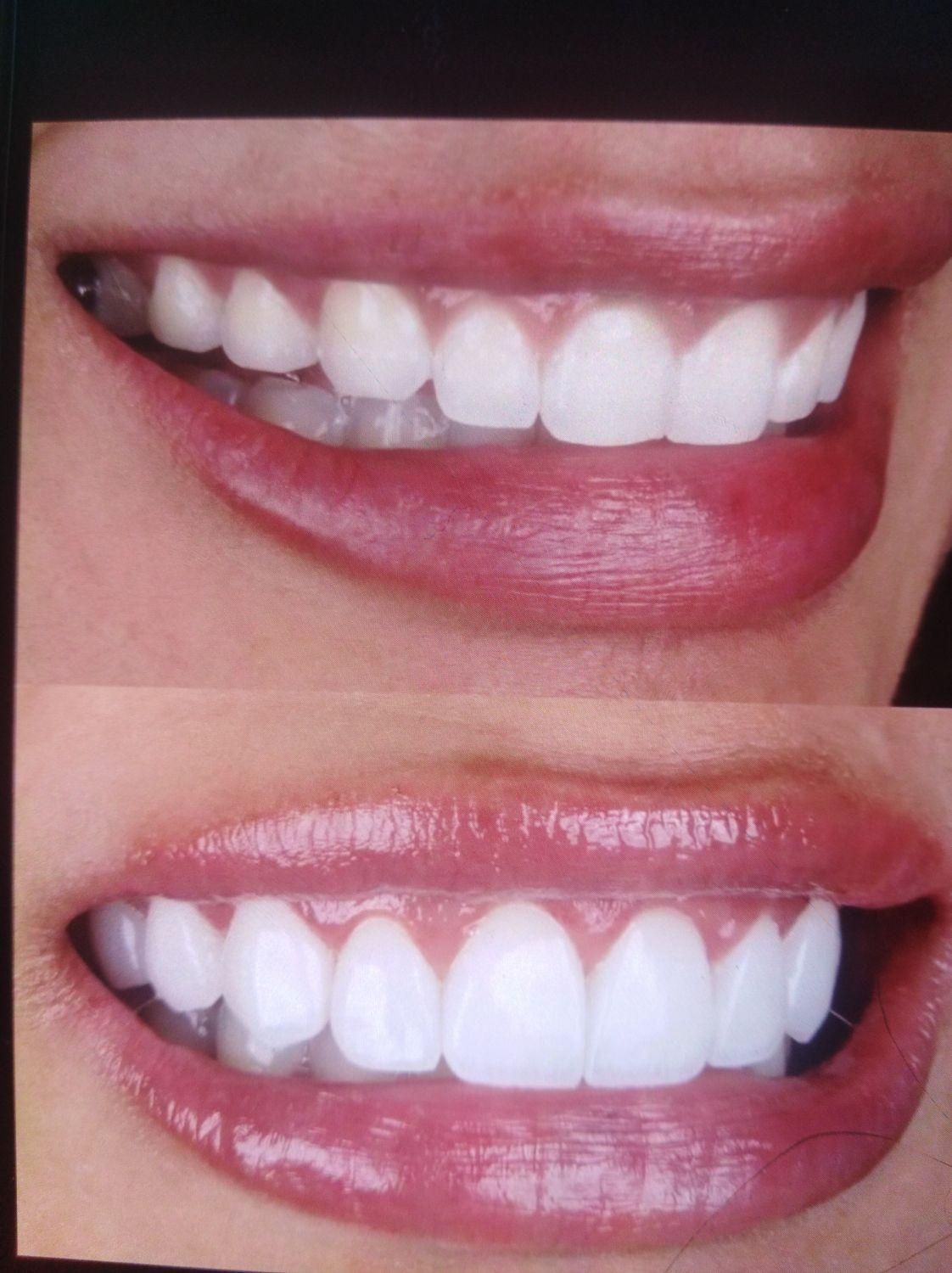 آفر ویژه کامپوزیت و لمینت|خدمات آرایشگری و زیبایی|بوشهر, |دیوار