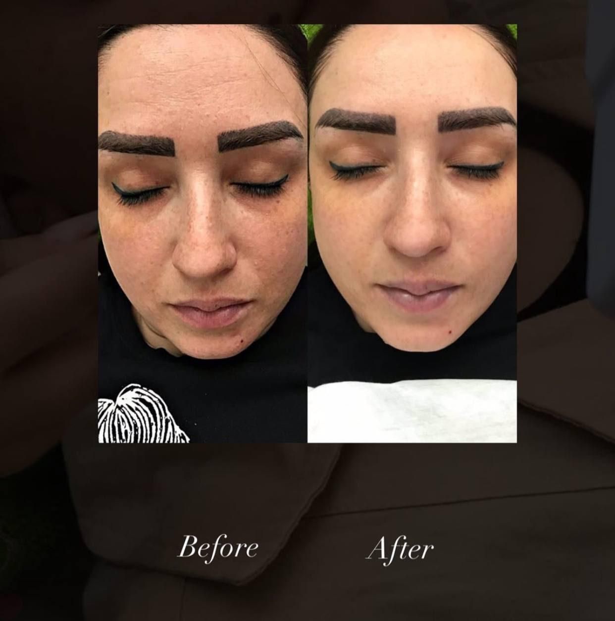 مدل برای پاکسازی پوست|استخدام درمانی، زیبایی، بهداشتی|تبریز, |دیوار