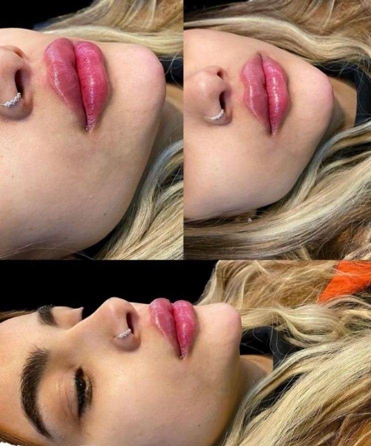 جشنواره تزریق ژل و بوتاکس و آموزش|خدمات آرایشگری و زیبایی|اصفهان, بهار آزادی|دیوار