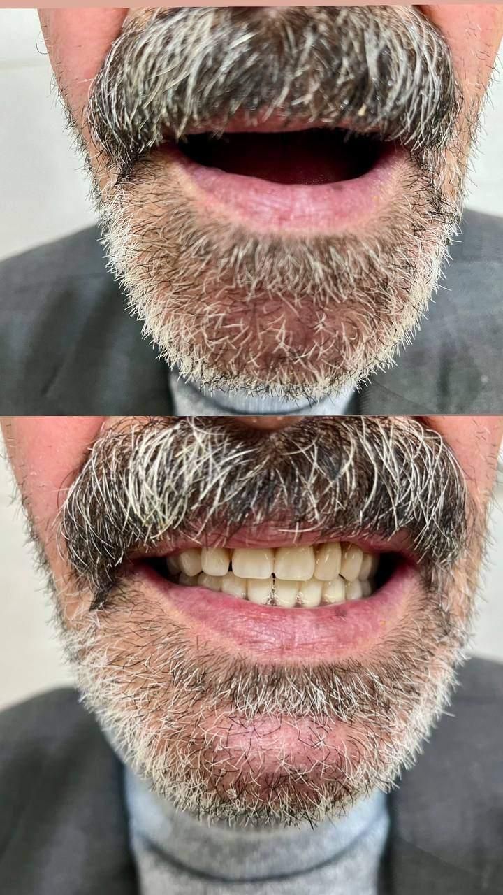 دندانسازی محلات|خدمات آرایشگری و زیبایی|محلات, |دیوار