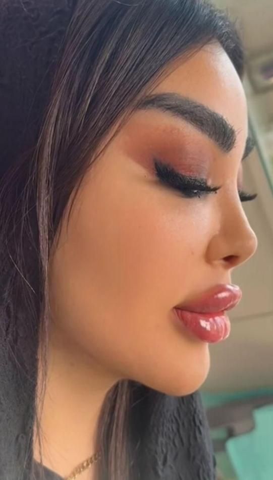 ژل بوتاکس مزو فیلر انزیم فیلر فشیال|خدمات آرایشگری و زیبایی|اسلام‌شهر, مطهری|دیوار