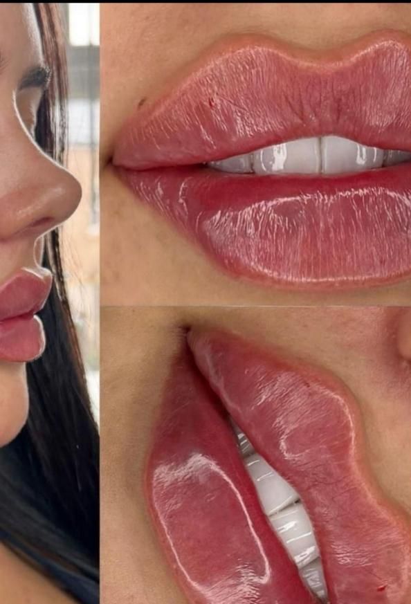 آموزش ژل فیلر لب چانه انزیم چاقی صورت مزو مو فشیال|خدمات آرایشگری و زیبایی|قم, زنبیل آباد|دیوار