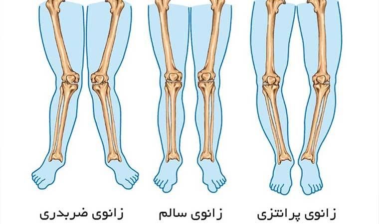 آموزش حرکات اصلاحی با ارائه گواهینامه دانشگاهی|خدمات آموزشی|تهران, میدان ولیعصر|دیوار