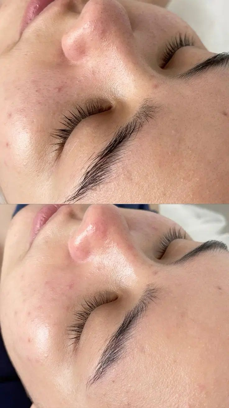 خدمات تخصصی پاکسازی و فیشیال پوست|خدمات آرایشگری و زیبایی|کرج, آق تپه|دیوار