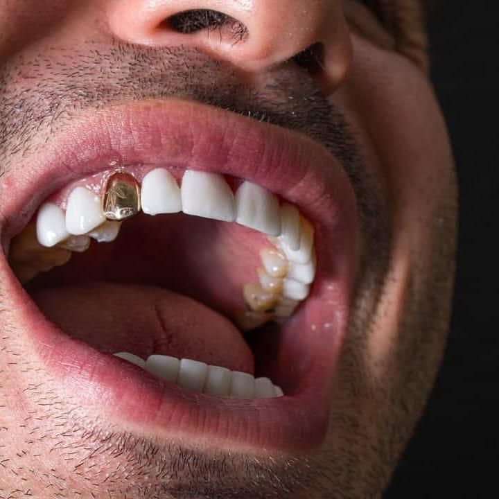 دندانپزشکی کامپوزیت و درمانی|خدمات آرایشگری و زیبایی|تهران, سلسبیل جنوبی|دیوار