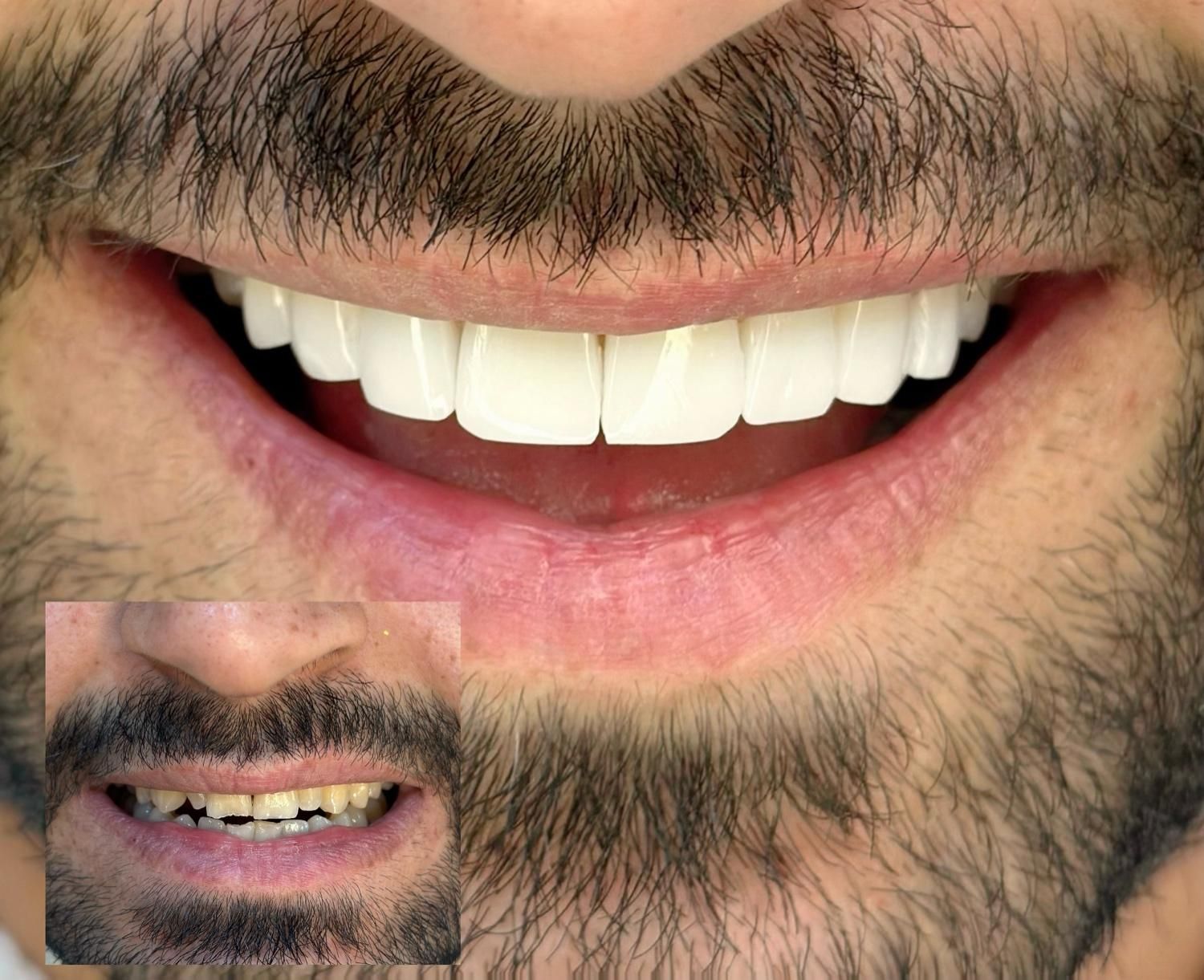 دندانپزشکی با کیفیت بصورت اقساطی|خدمات آرایشگری و زیبایی|شیراز, قدوسی غربی|دیوار