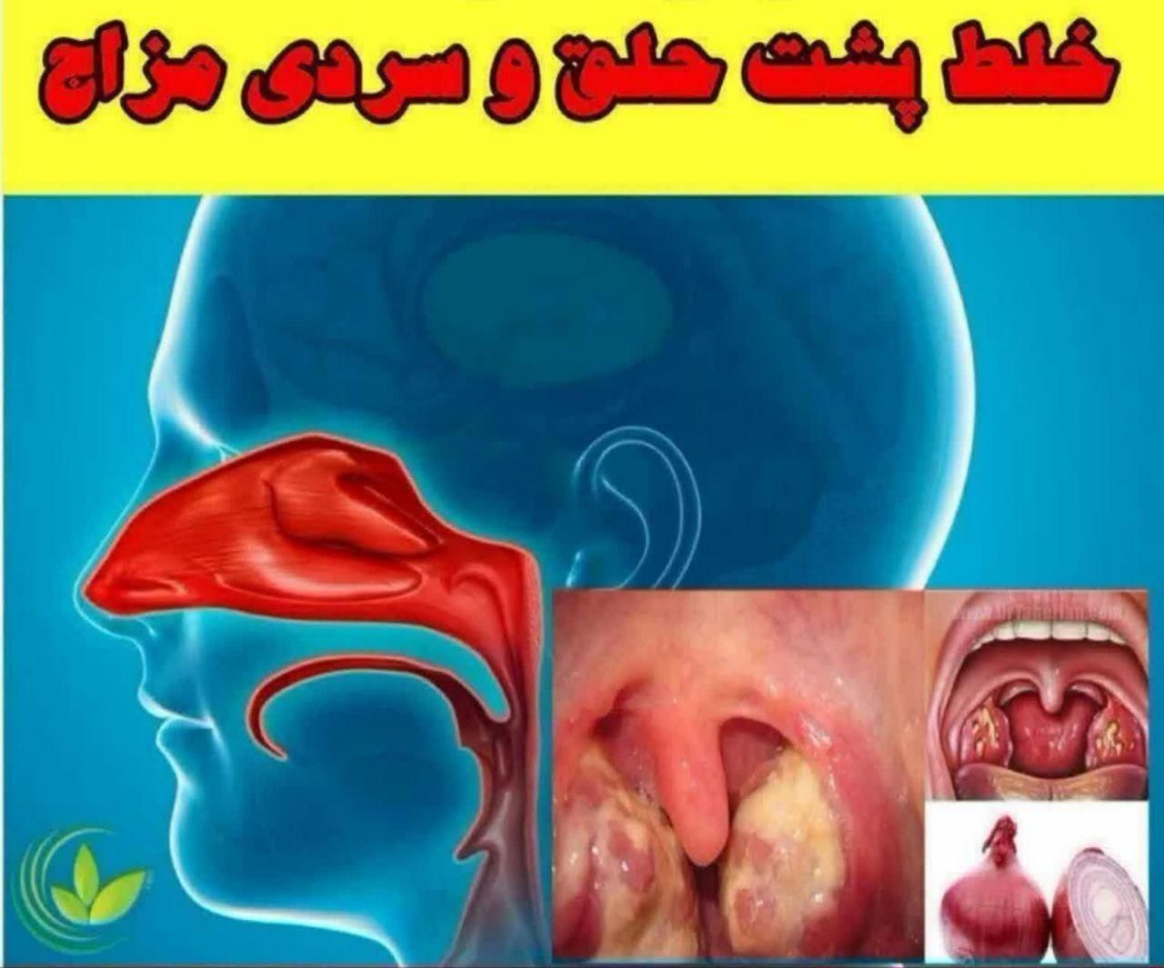 درمان خلط پشت حلق و کبدچرب و استرس و اعصاب|آرایشی، بهداشتی، درمانی|تهران, شهرک ولیعصر جنوبی|دیوار