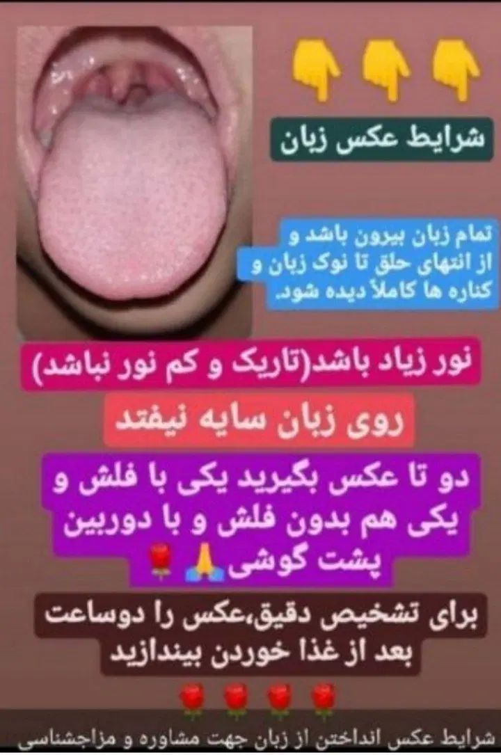 شناخت بیماری از روی عکس زبان شما|فعالیت داوطلبانه|مشهد, امیریه|دیوار