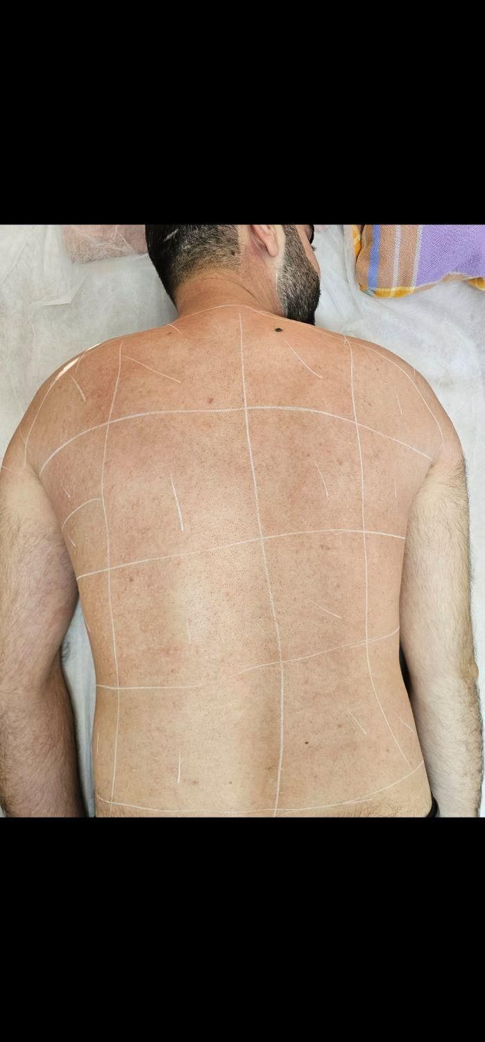 لیزر مو زائد الیت پلاس سایناشور|خدمات آرایشگری و زیبایی|تهران, مهران (سیدخندان)|دیوار