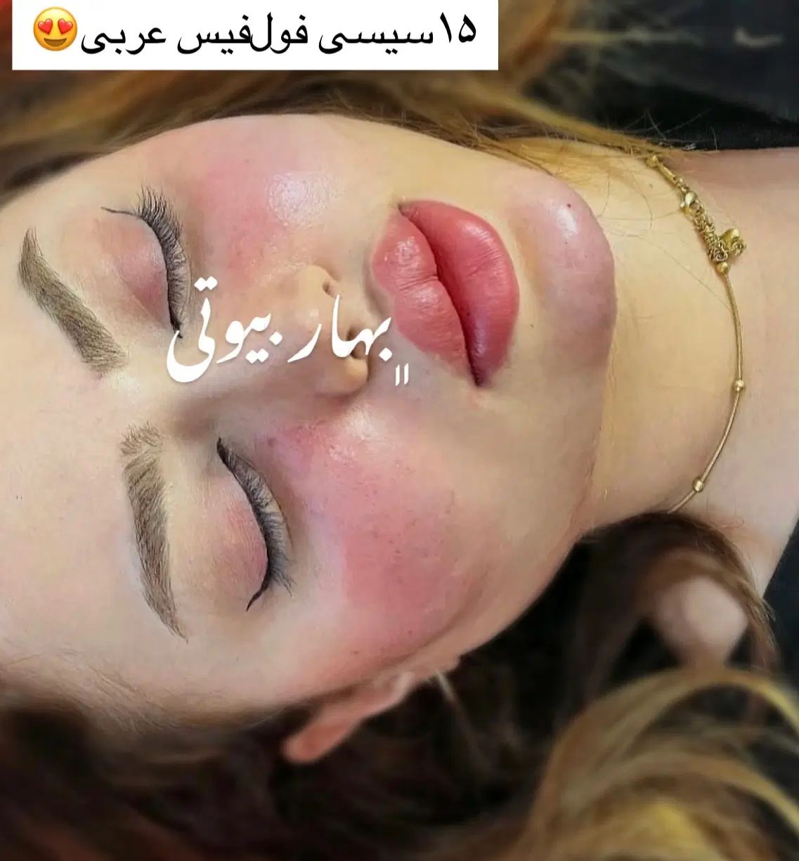 تخفیف خدمات تخصصی ژل بوتاکس مادلینگ مزوتراپی آنزیم|خدمات آرایشگری و زیبایی|کرمانشاه, |دیوار