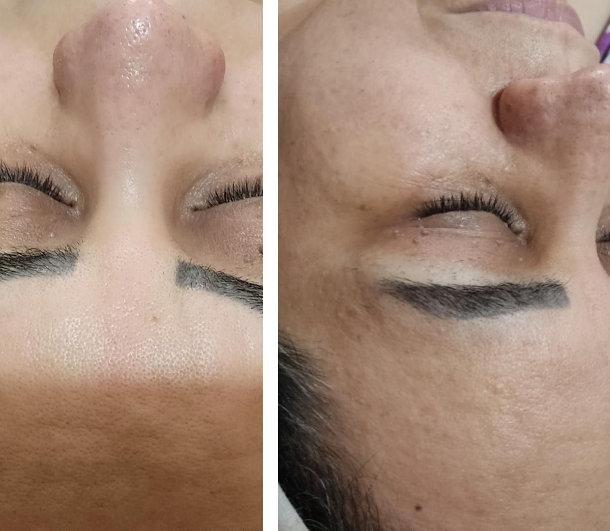 پاکسازی پوست|خدمات آرایشگری و زیبایی|مشهد, گلبرگ|دیوار