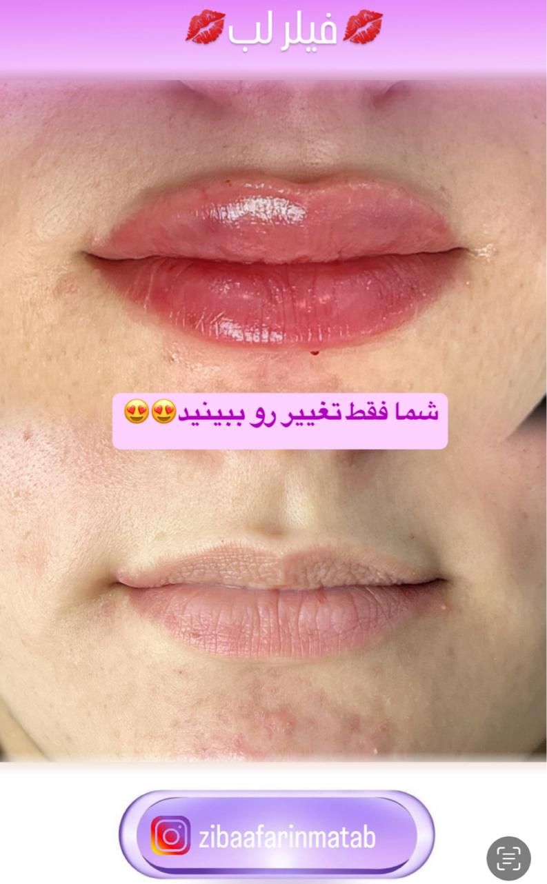 کلینیک زیبای و جراحی|خدمات آرایشگری و زیبایی|بندر گناوه, |دیوار