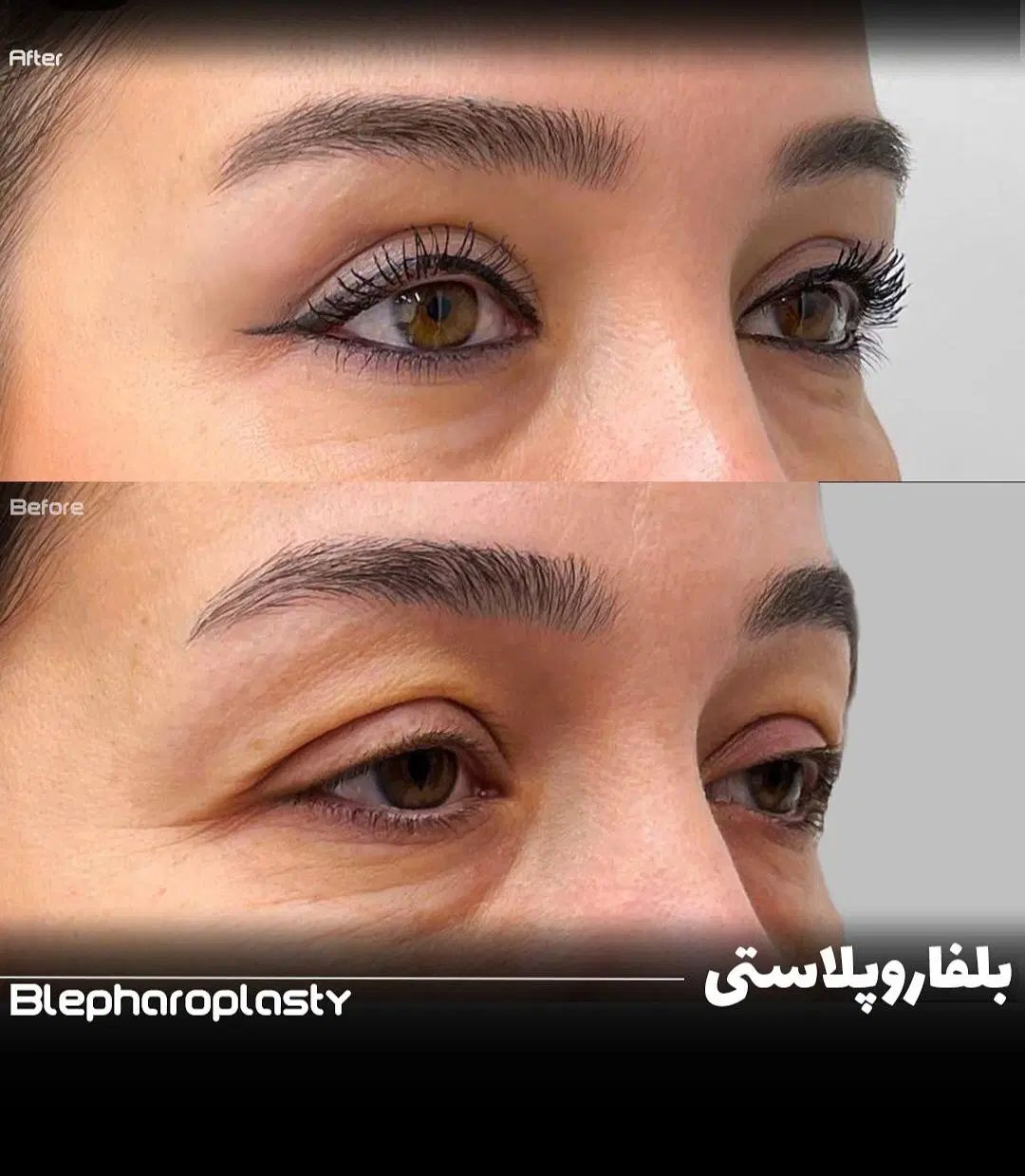 لیزیک چشم /لیپوماتیک /آبدومینو/ کاشت مو/بلفارو|خدمات آرایشگری و زیبایی|کرمانشاه, |دیوار