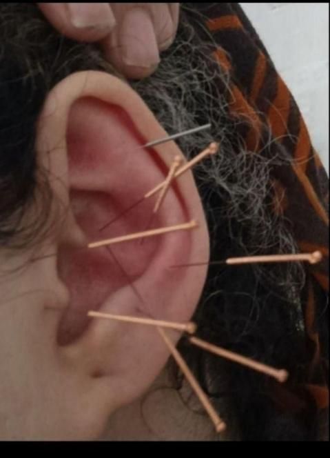 طب سوزنی بادکش گرم مشاوره تغذیه حجامت عام زالو|خدمات آرایشگری و زیبایی|اصفهان, ملکشهر|دیوار