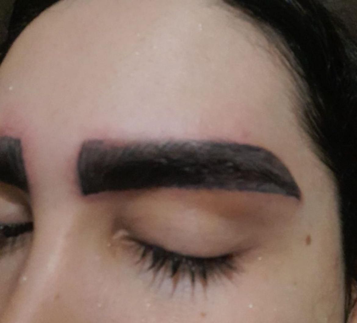 لیزر پاک کردن تاتو بدن و صورت|خدمات آرایشگری و زیبایی|محمدشهر, محمدشهر|دیوار