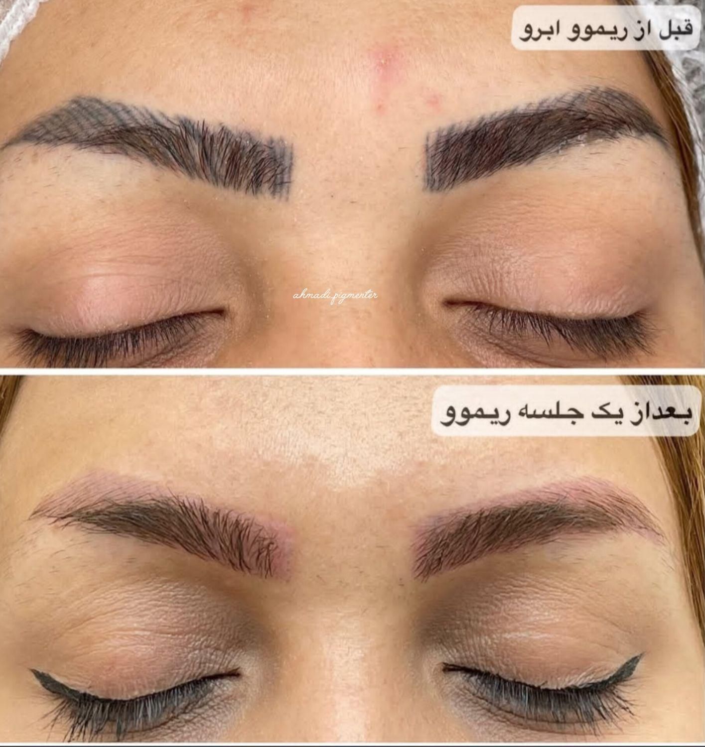 ریموو،میکروبلیدینگ،خط چشم و شیدینگ|خدمات آرایشگری و زیبایی|کرمانشاه, |دیوار