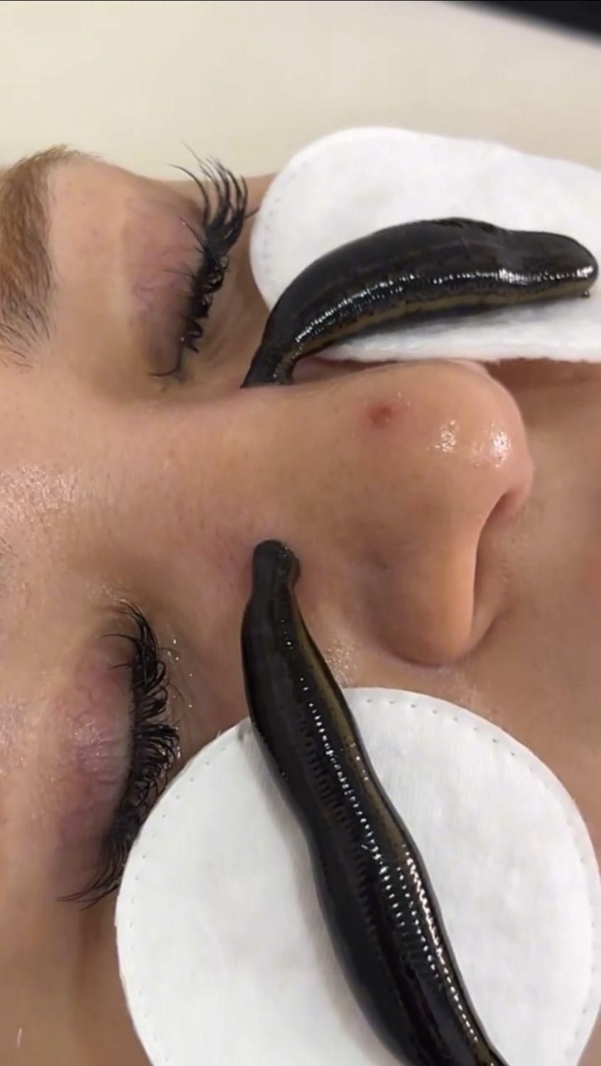 رگگیری.اصلاحی.زالودرمانی.حجامت.اصلاحی|خدمات آرایشگری و زیبایی|کاشان, دشت چال|دیوار