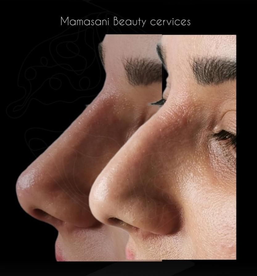 مطب زیبایی و لیزر با ده سال سابقه (فلکه جهاد)|خدمات آرایشگری و زیبایی|نورآباد ممسنی, |دیوار