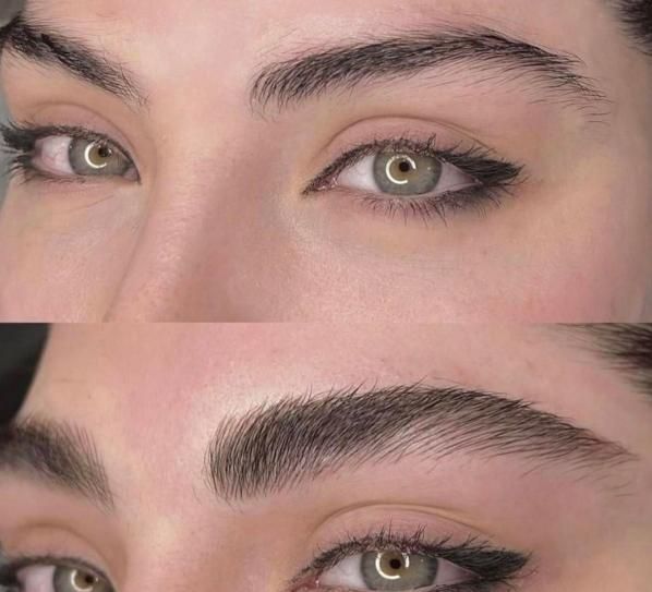 میکروبلیدینگ فیبروز|خدمات آرایشگری و زیبایی|بم, |دیوار