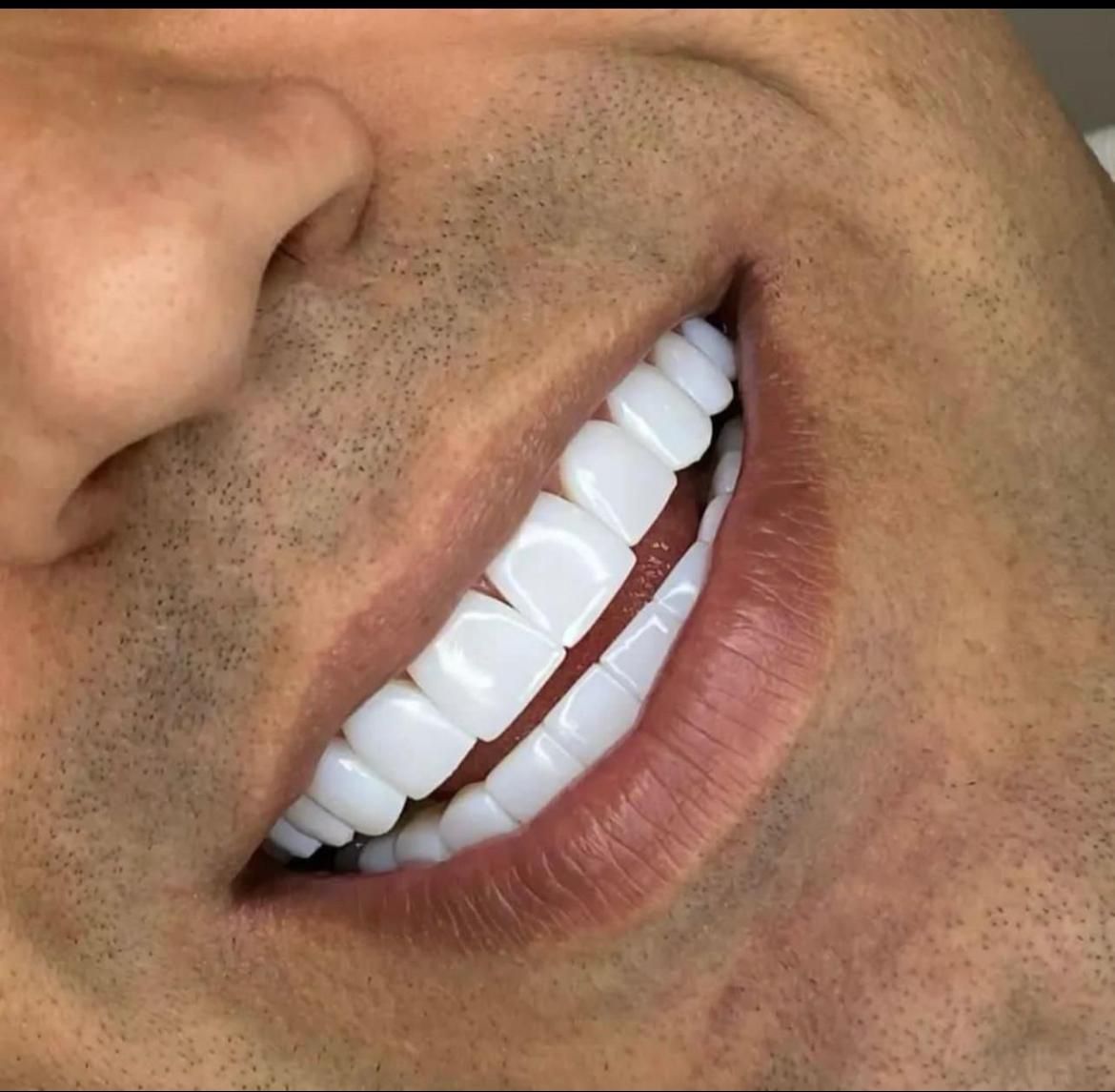 زیبایی دندان و ترمیم و درمان تخصصی|خدمات آرایشگری و زیبایی|ملارد, |دیوار