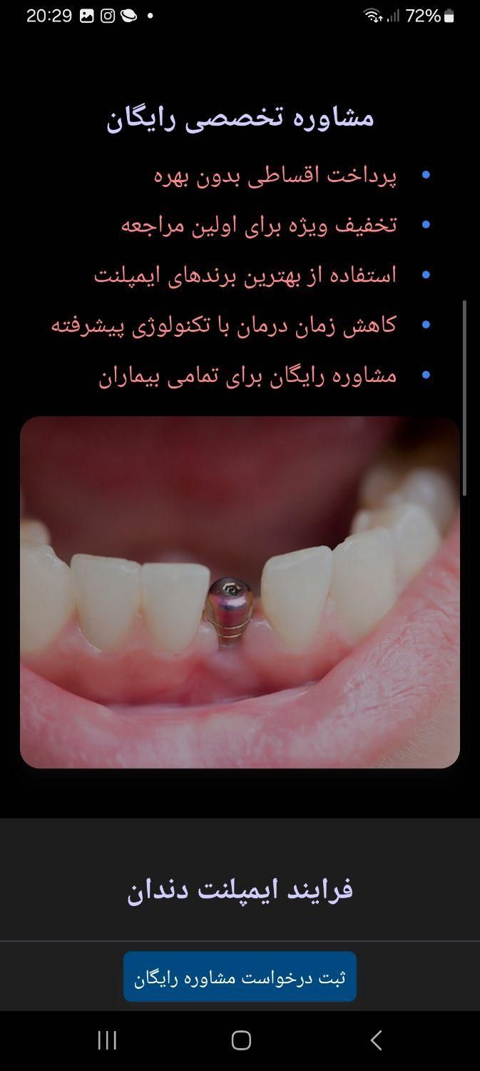 ایمپلنت  فوری.اوردنچر .عصب کشی ،ترمیم پوسیدگی|خدمات آرایشگری و زیبایی|تهران, تهرانپارس غربی|دیوار