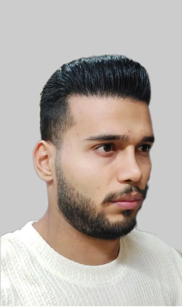 کاشت مووابرو با تخفیف درکلینیک تخصصی تبریز|خدمات آرایشگری و زیبایی|اردبیل, |دیوار