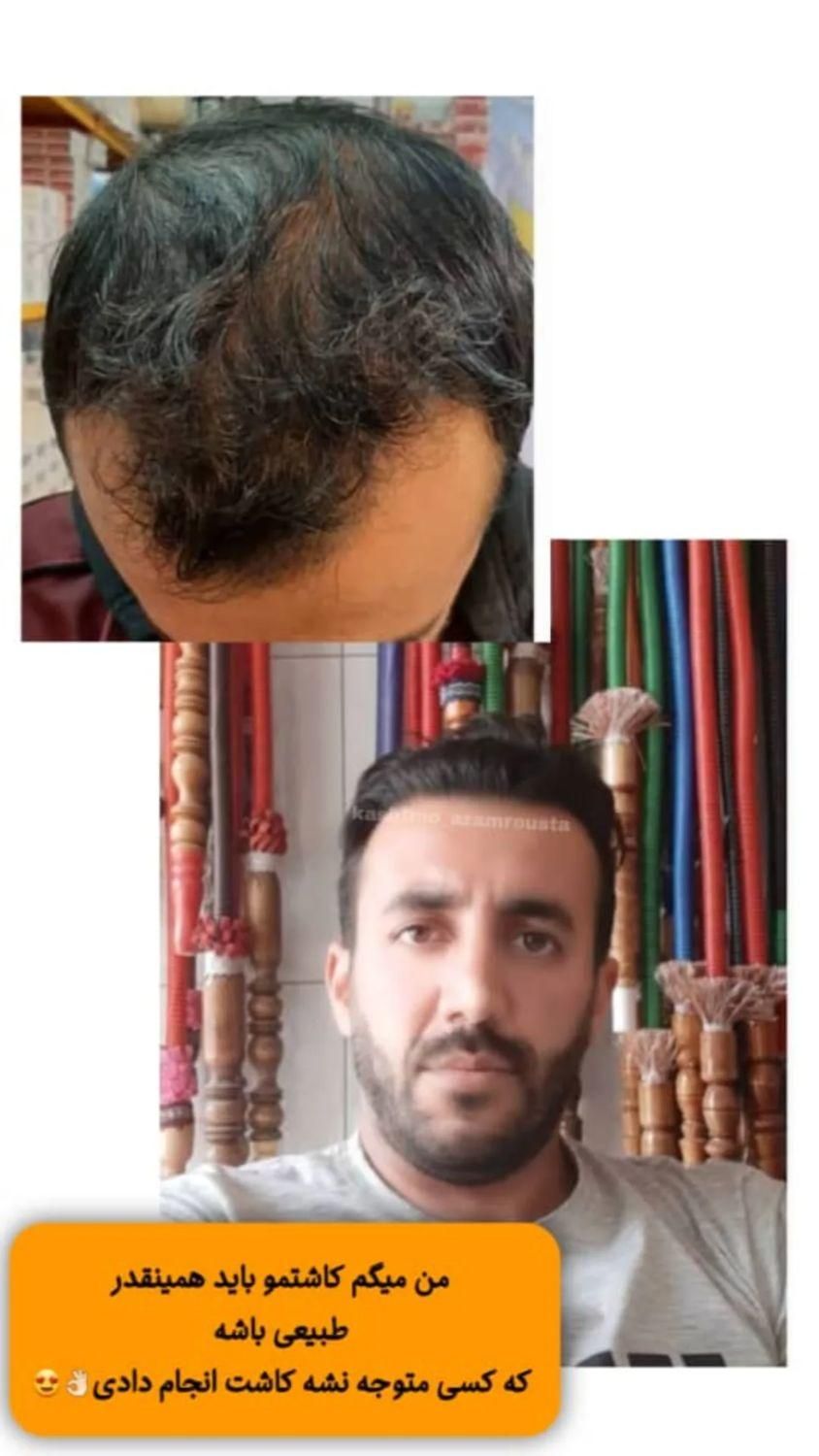 کاشت مو و ابرو هستی..اعظم روستا|خدمات آرایشگری و زیبایی|تهران, کرمان|دیوار