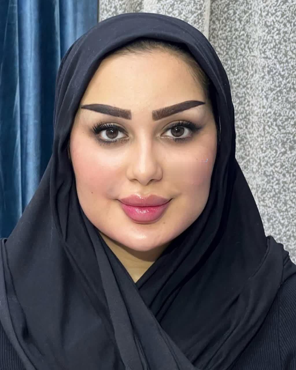 رینو جراحی عمل زیبایی بینی چربی لیپو سانترال پلک|خدمات آرایشگری و زیبایی|تهران, ونک|دیوار