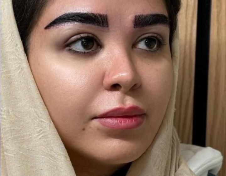 مدل کاشت مو و ابرو جهت تولید محتوا|خدمات آرایشگری و زیبایی|قم, پردیسان|دیوار